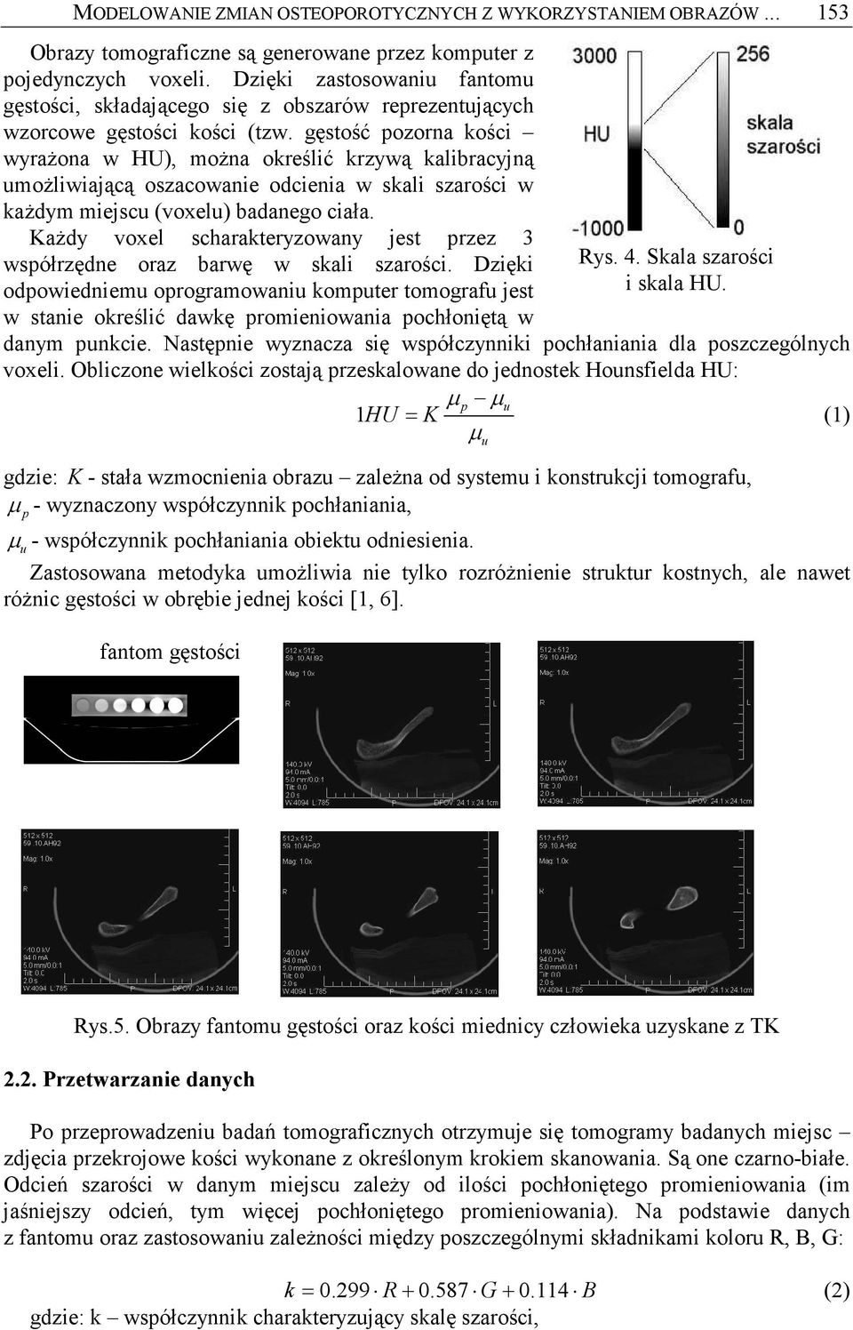 gęstość pozorna kości wyraŝona w HU), moŝna określić krzywą kalibracyjną umoŝliwiającą oszacowanie odcienia w skali szarości w kaŝdym miejscu (voxelu) badanego ciała.