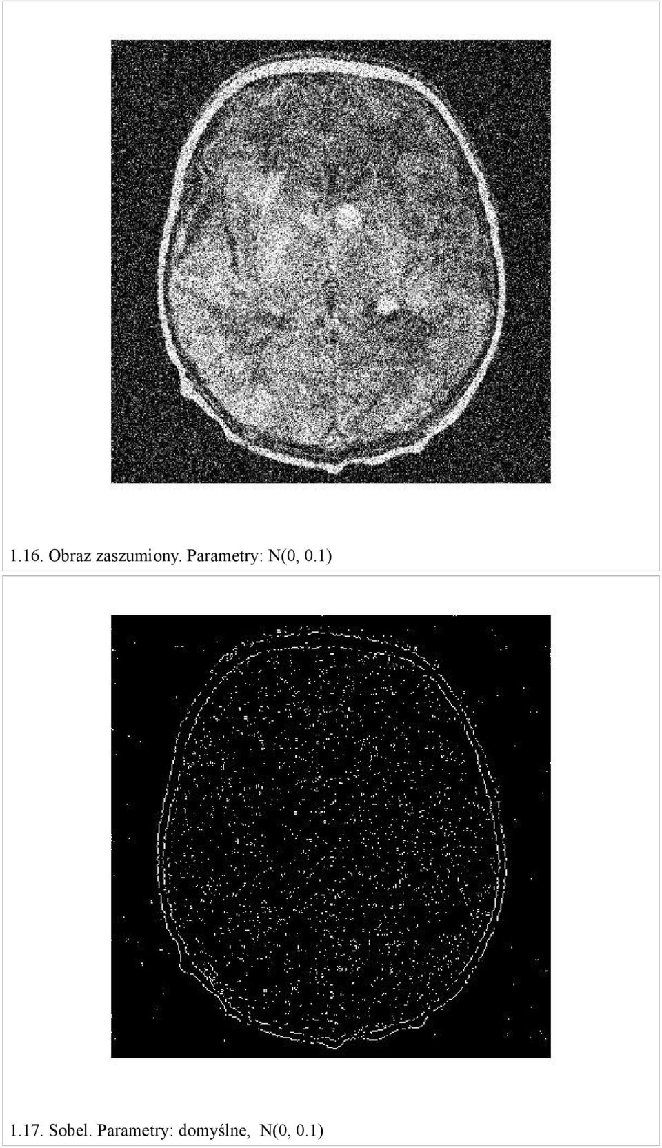 Parametry: N(0, 0.