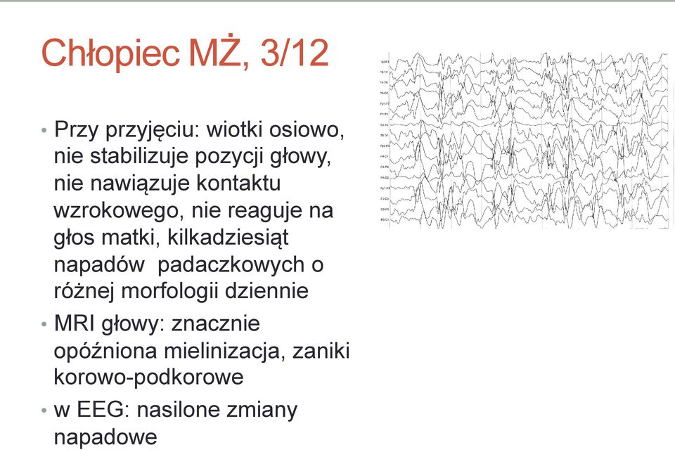 kilkadziesiąt napadów padaczkowych o różnej morfologii dziennie MRI głowy: