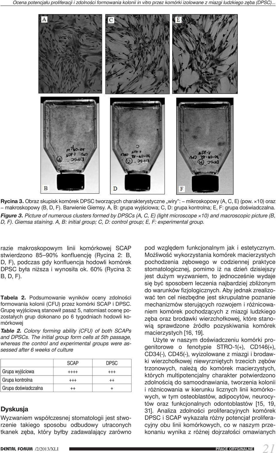 A, B: grupa wyjściowa; C, D: grupa kontrolna; E, F: grupa doświadczalna. Figure 3. Picture of numerous clusters formed by DPSCs (A, C, E) (light microscope 10) and macroscopic picture (B, D, F).