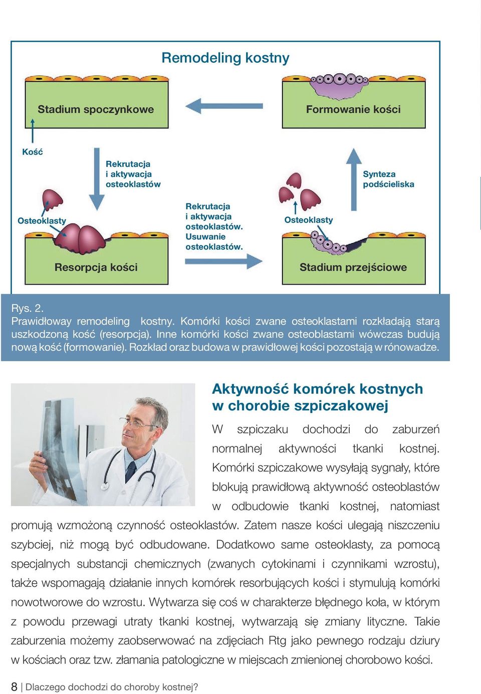 Inne komórki kości zwane osteoblastami wówczas budują nową kość (formowanie). Rozkład oraz budowa w prawidłowej kości pozostają w rónowadze. 8 Dlaczego dochodzi do choroby kostnej?