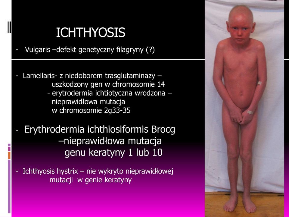 ichtiotyczna wrodzona nieprawidłowa mutacja w chromosomie 2g33-35 - Erythrodermia