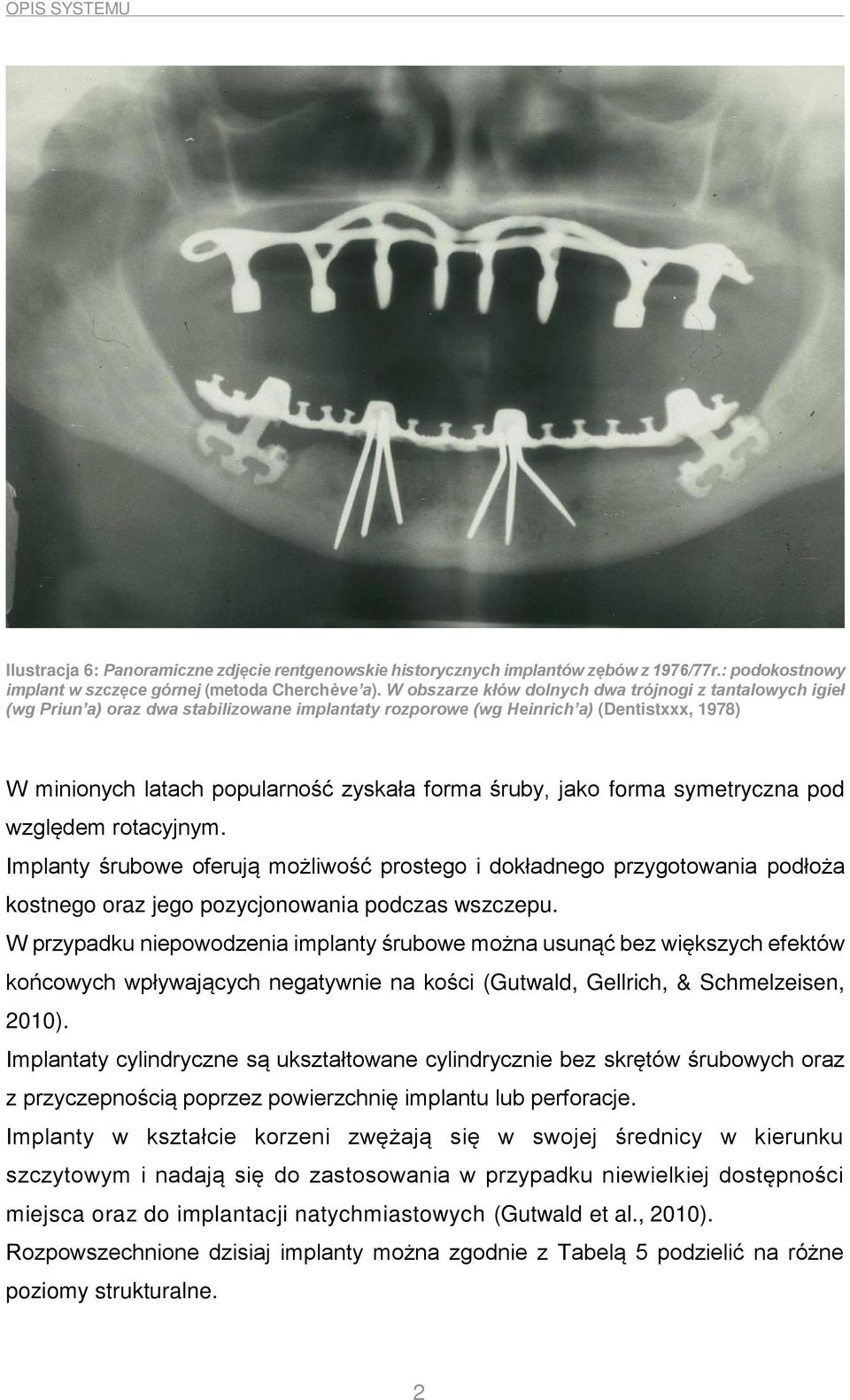 śruby, jako forma symetryczna pod względem rotacyjnym. Implanty śrubowe oferują możliwość prostego i dokładnego przygotowania podłoża kostnego oraz jego pozycjonowania podczas wszczepu.