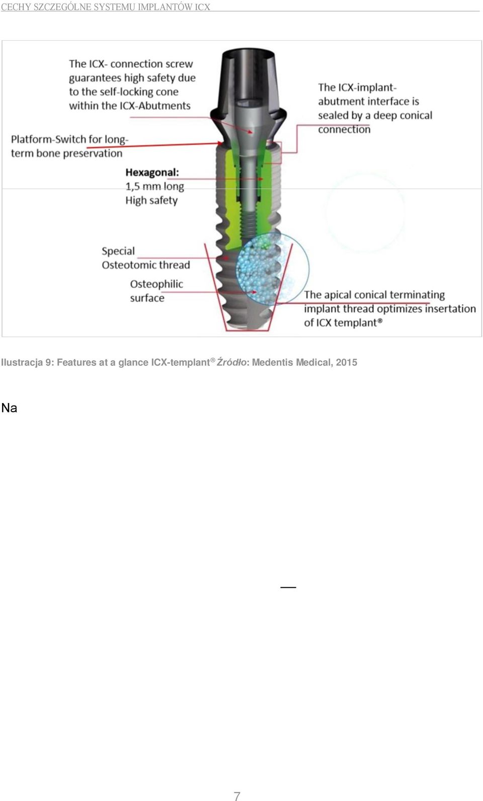 Struktura implantu z mikrogwintem w obszarze szyjki implantu przyczynia się do lepszego korowego kontaktu z kością i powinna prowadzić do optymalnego fizjologicznego przyłożenia siły w tym obszarze.