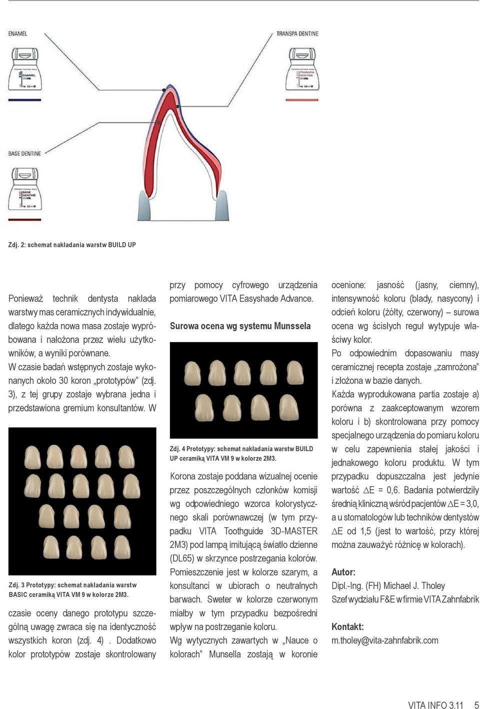 3 Prototypy: schemat nakładania warstw BASIC ceramiką VITA VM 9 w kolorze 2M3. czasie oceny danego prototypu szczególną uwagę zwraca się na identyczność wszystkich koron (zdj. 4).