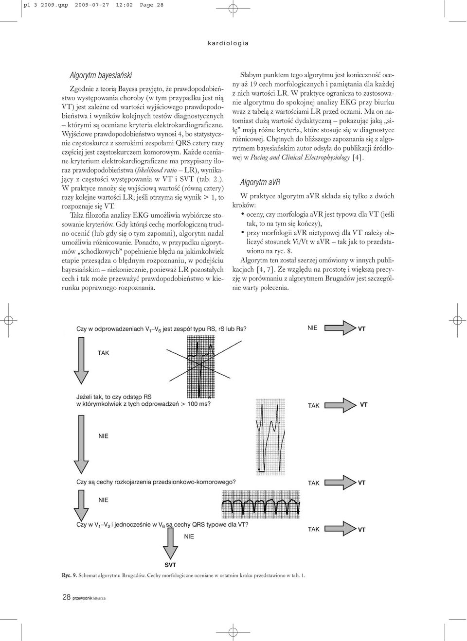 prawdopodobieñstwa i wyników kolejnych testów diagnostycznych którymi s¹ oceniane kryteria elektrokardiograficzne.