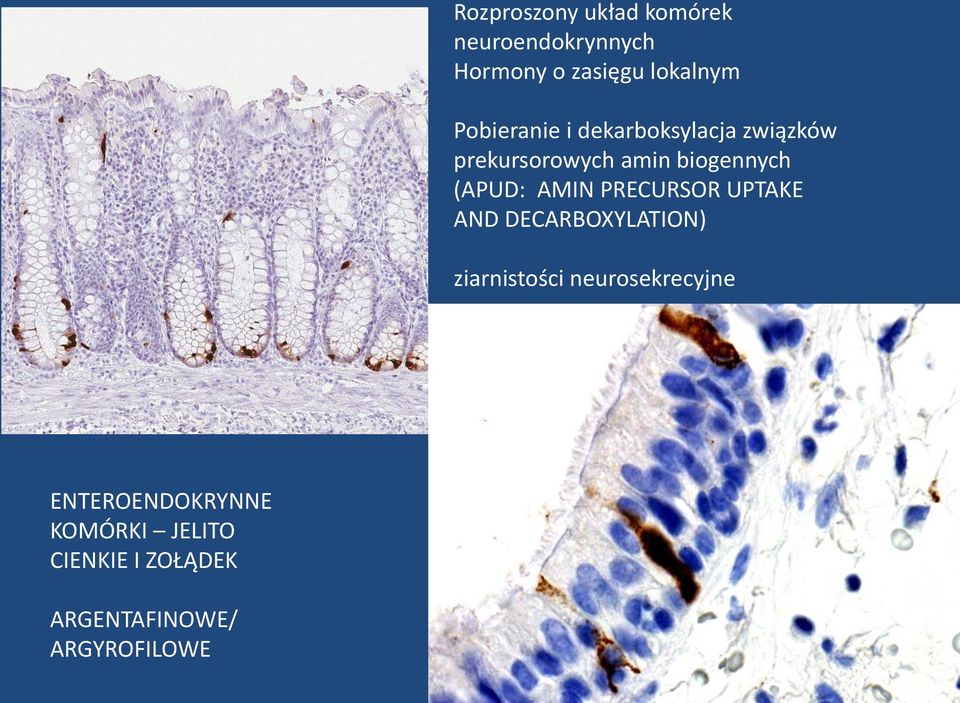 (APUD: AMIN PRECURSOR UPTAKE AND DECARBOXYLATION) ziarnistości