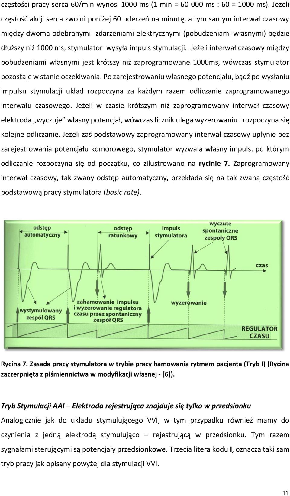 stymulator wysyła impuls stymulacji. Jeżeli interwał czasowy między pobudzeniami własnymi jest krótszy niż zaprogramowane 1000ms, wówczas stymulator pozostaje w stanie oczekiwania.