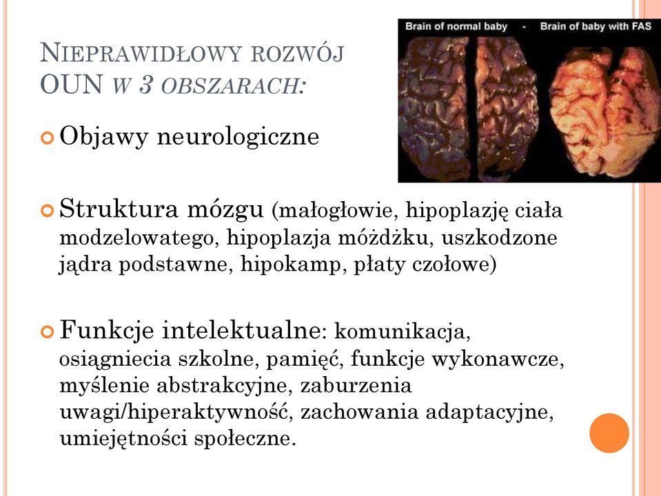 czołowe) Funkcje intelektualne: komunikacja, osiągniecia szkolne, pamięć, funkcje wykonawcze,