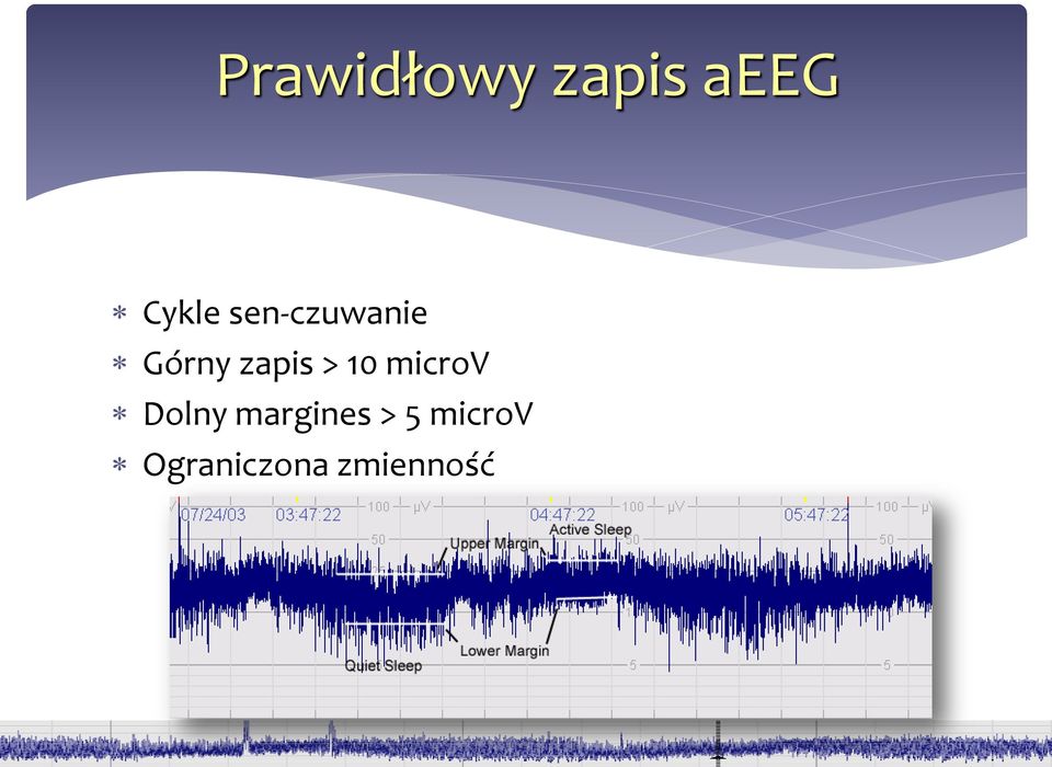 10 microv Dolny margines >