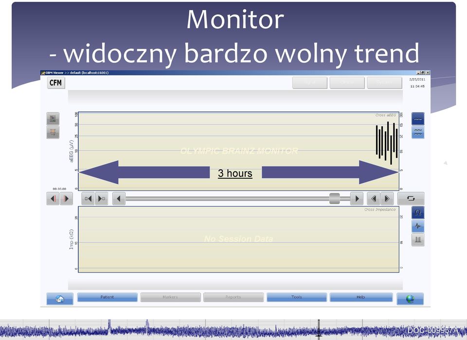 bardzo wolny