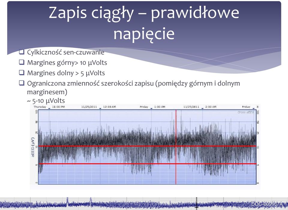 napięcie Ograniczona zmienność szerokości zapisu