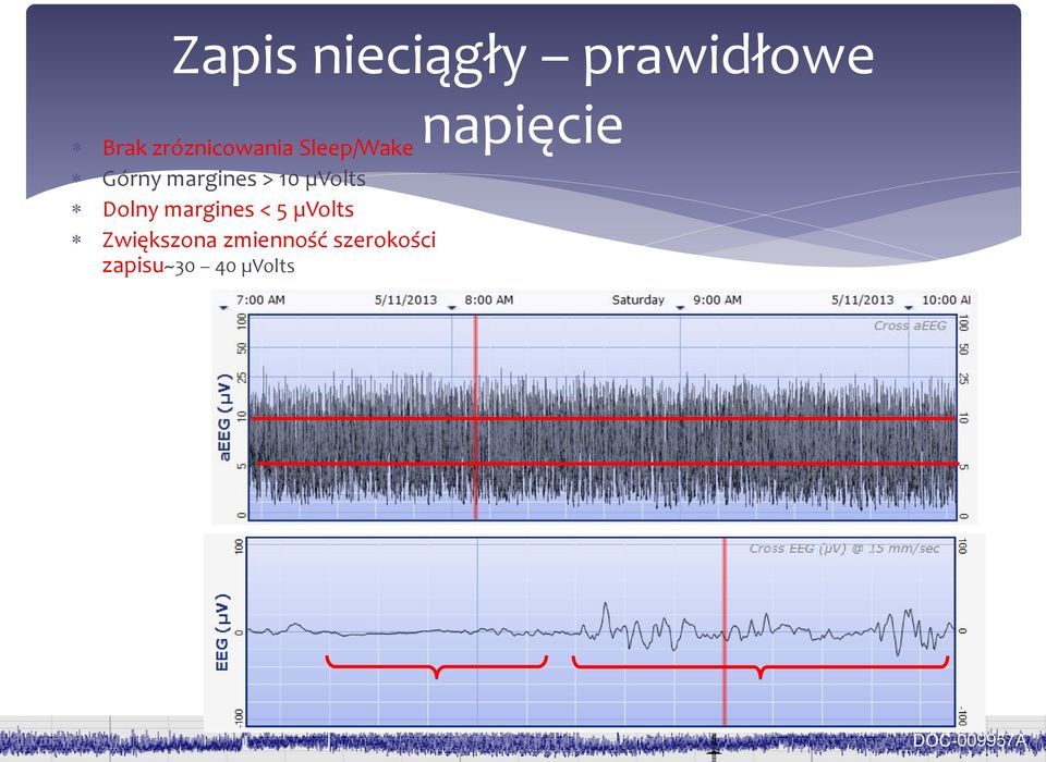 margines < 5 µvolts Zwiększona zmienność