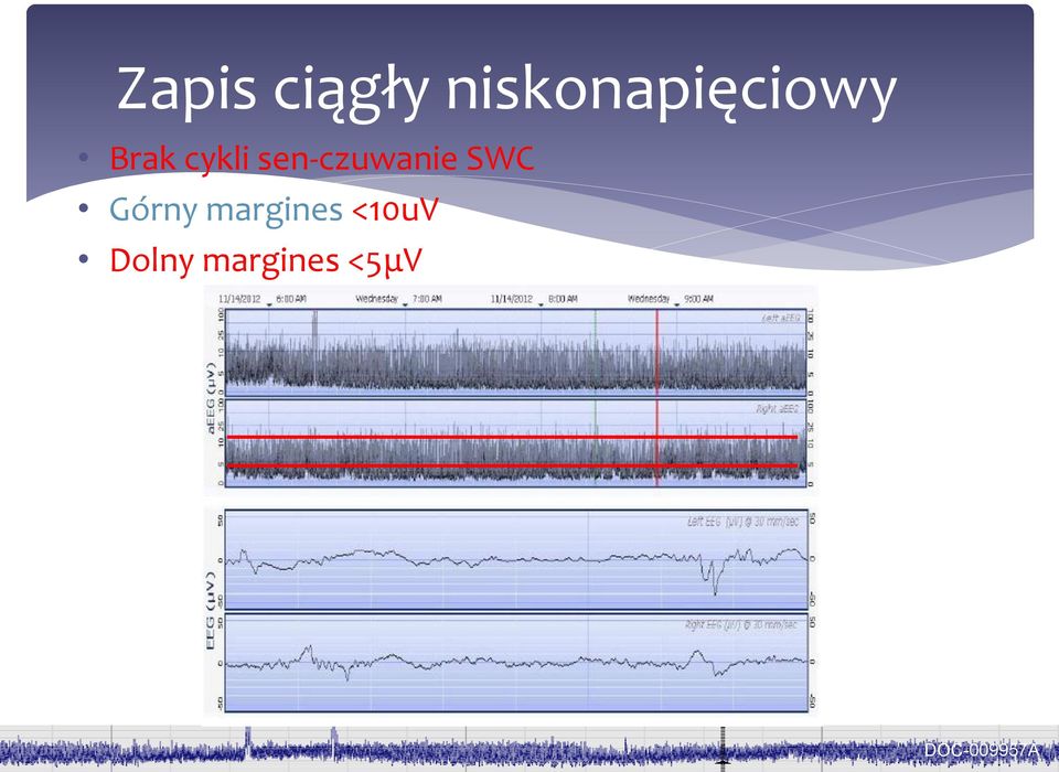 sen-czuwanie SWC Górny