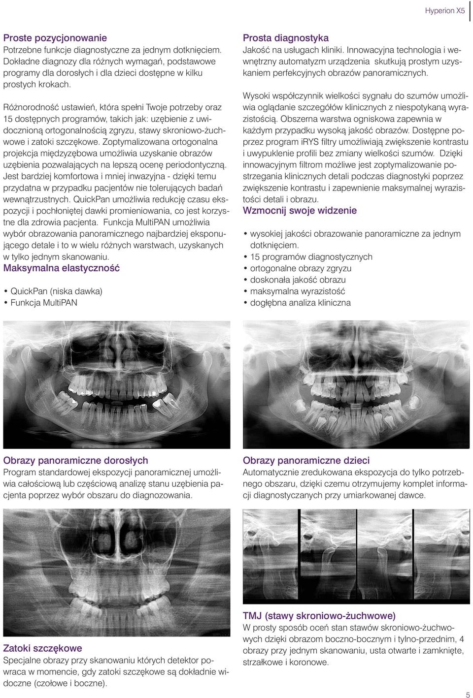 Zoptymalizowana orto gonalna projekcja mi dzyz bowa umo liwia uzyskanie obrazów uz bienia pozwalajàcych na lepszà ocen periodontycznà.