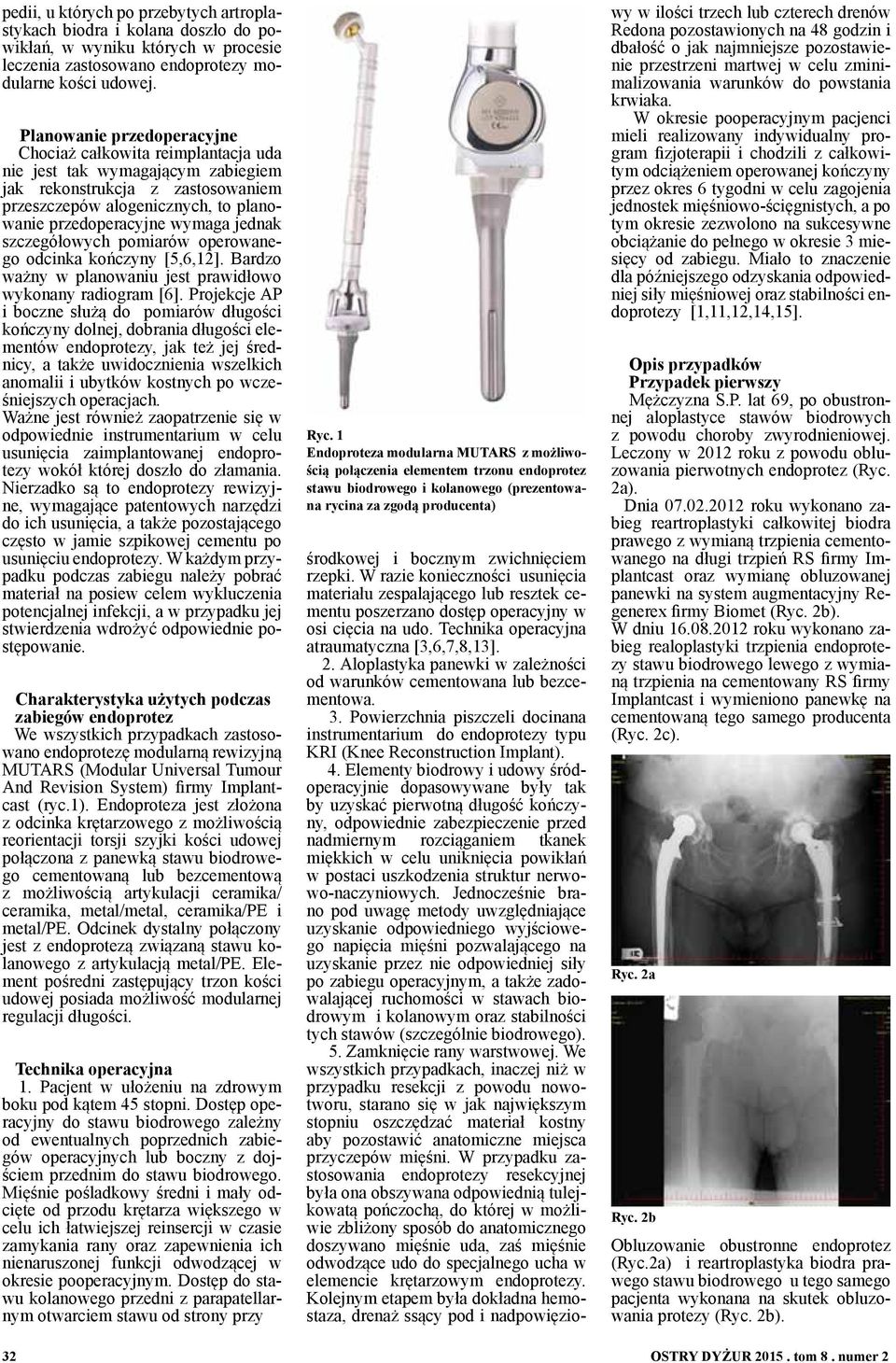 jednak szczegółowych pomiarów operowanego odcinka kończyny [5,6,12]. Bardzo ważny w planowaniu jest prawidłowo wykonany radiogram [6].