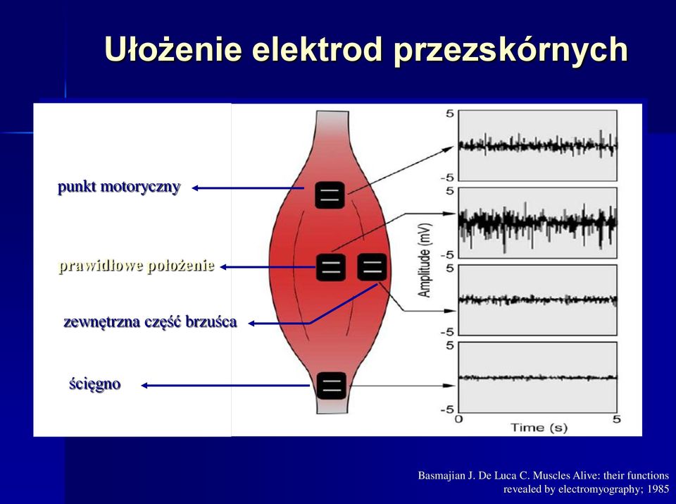 część brzuśca ścięgno Basmajian J. De Luca C.