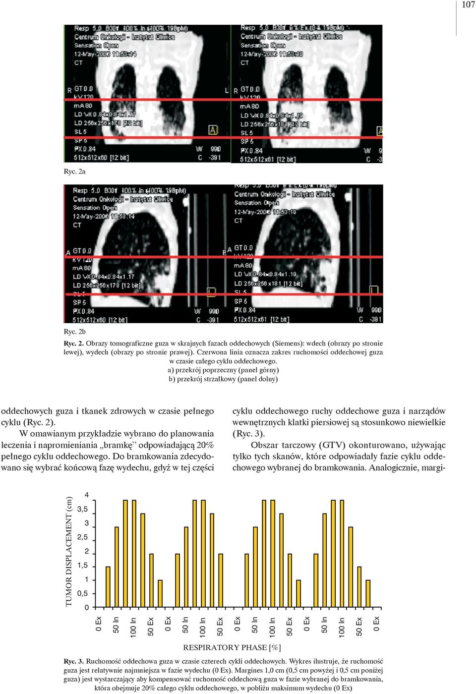 a) przekrój poprzeczny (panel górny) b) przekrój strzałkowy (panel dolny) oddechowych guza i tkanek zdrowych w czasie pełnego cyklu (Ryc. 2).