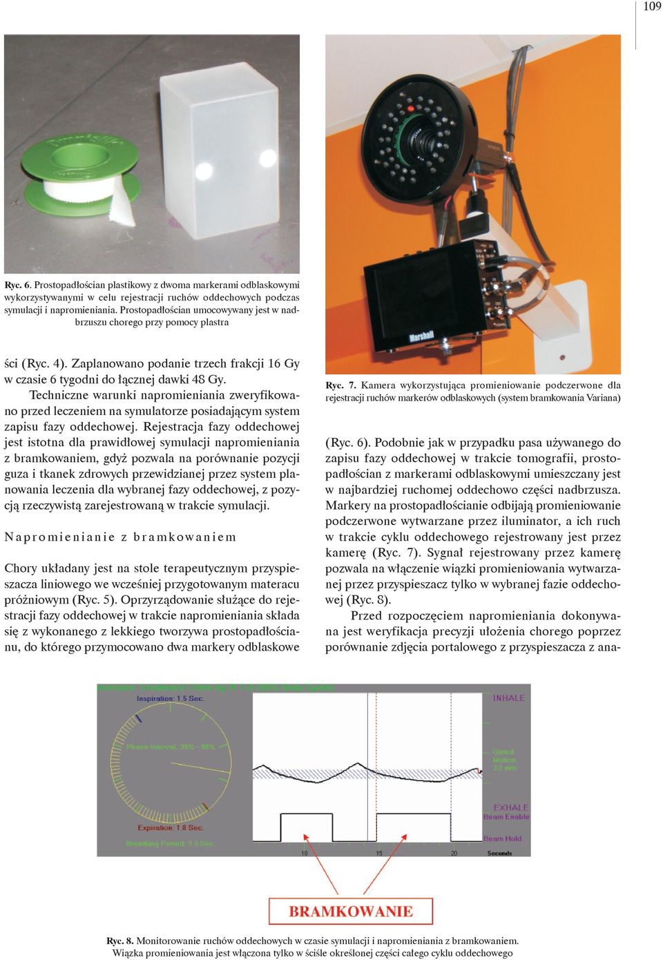 Techniczne warunki napromieniania zweryfikowano przed leczeniem na symulatorze posiadającym system zapisu fazy oddechowej.