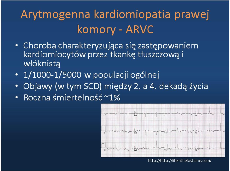 tłuszczową i włóknistą 1/1000-1/5000 w populacji ogólnej Objawy (w tym