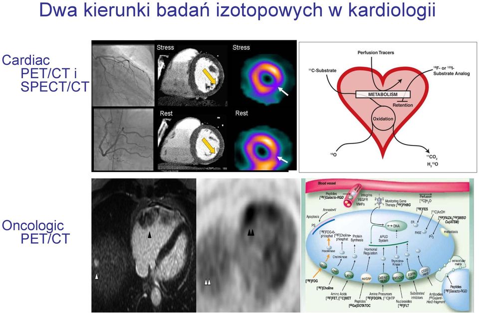 kardiologii Cardiac