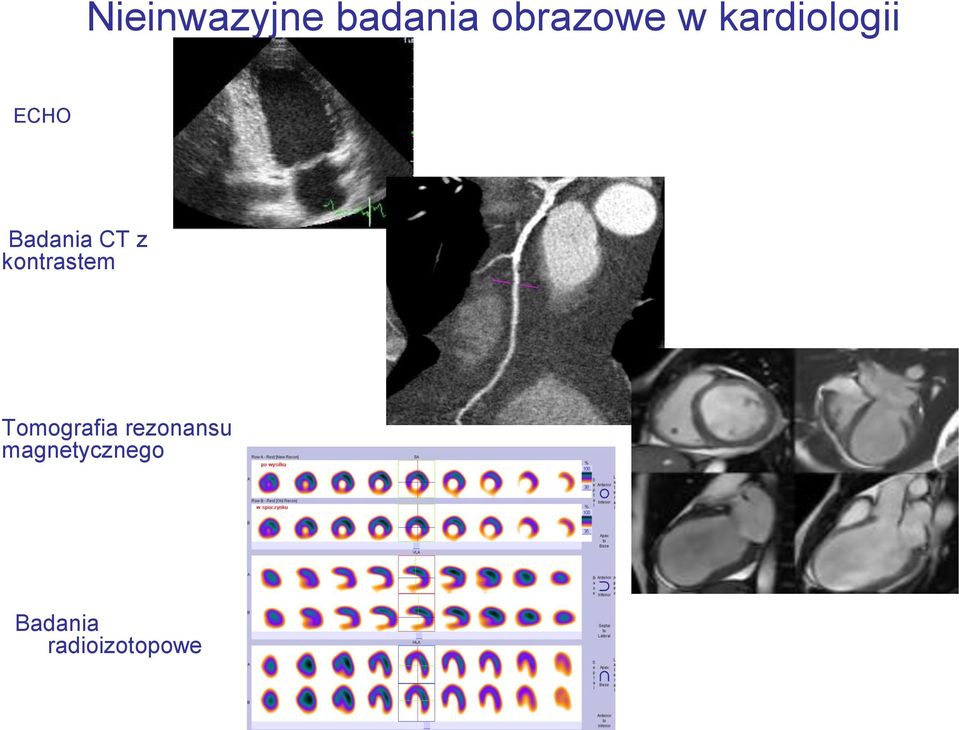 kontrastem Tomografia rezonansu