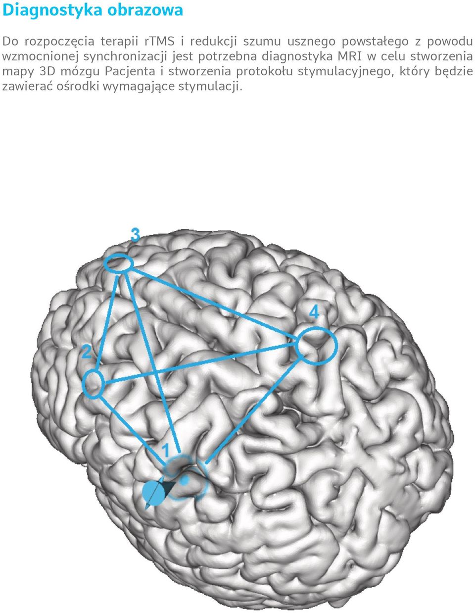 diagnostyka MRI w celu stworzenia mapy 3D mózgu Pacjenta i stworzenia