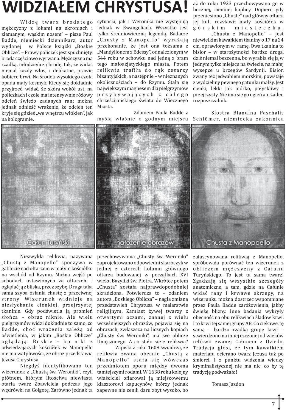 Prawy policzek jest spuchniêty, broda czêœciowo wyrwana. Mê czyzna ma rzadk¹, m³odzieñcz¹ brodê, tak, e widaæ niemal ka dy w³os, i delikatne, prawie kobiece brwi.