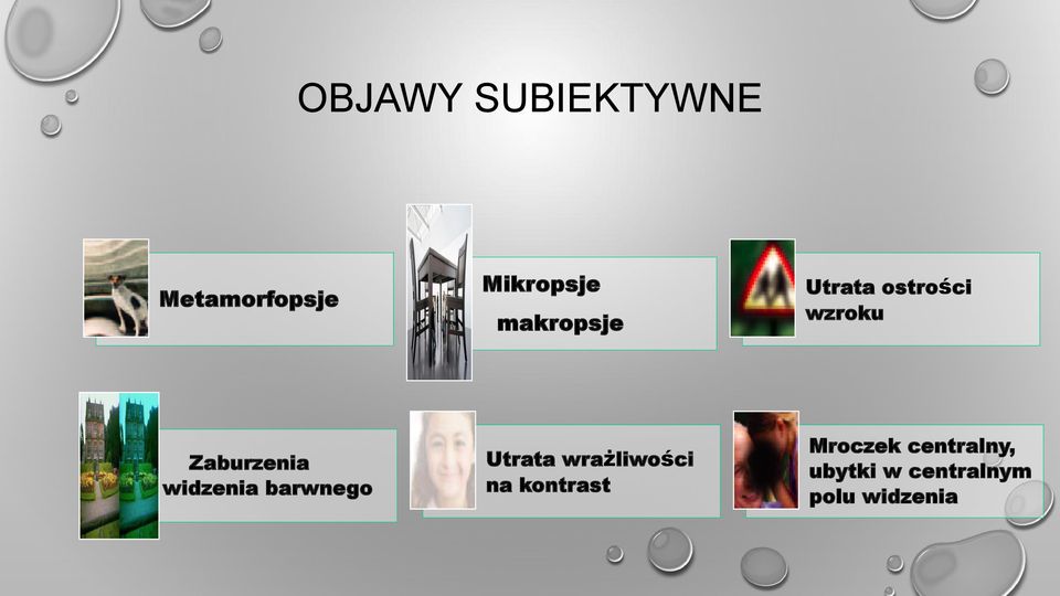 widzenia barwnego Utrata wrażliwości na