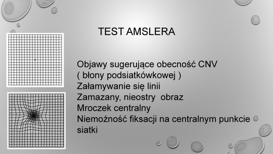 Zamazany, nieostry obraz Mroczek centralny