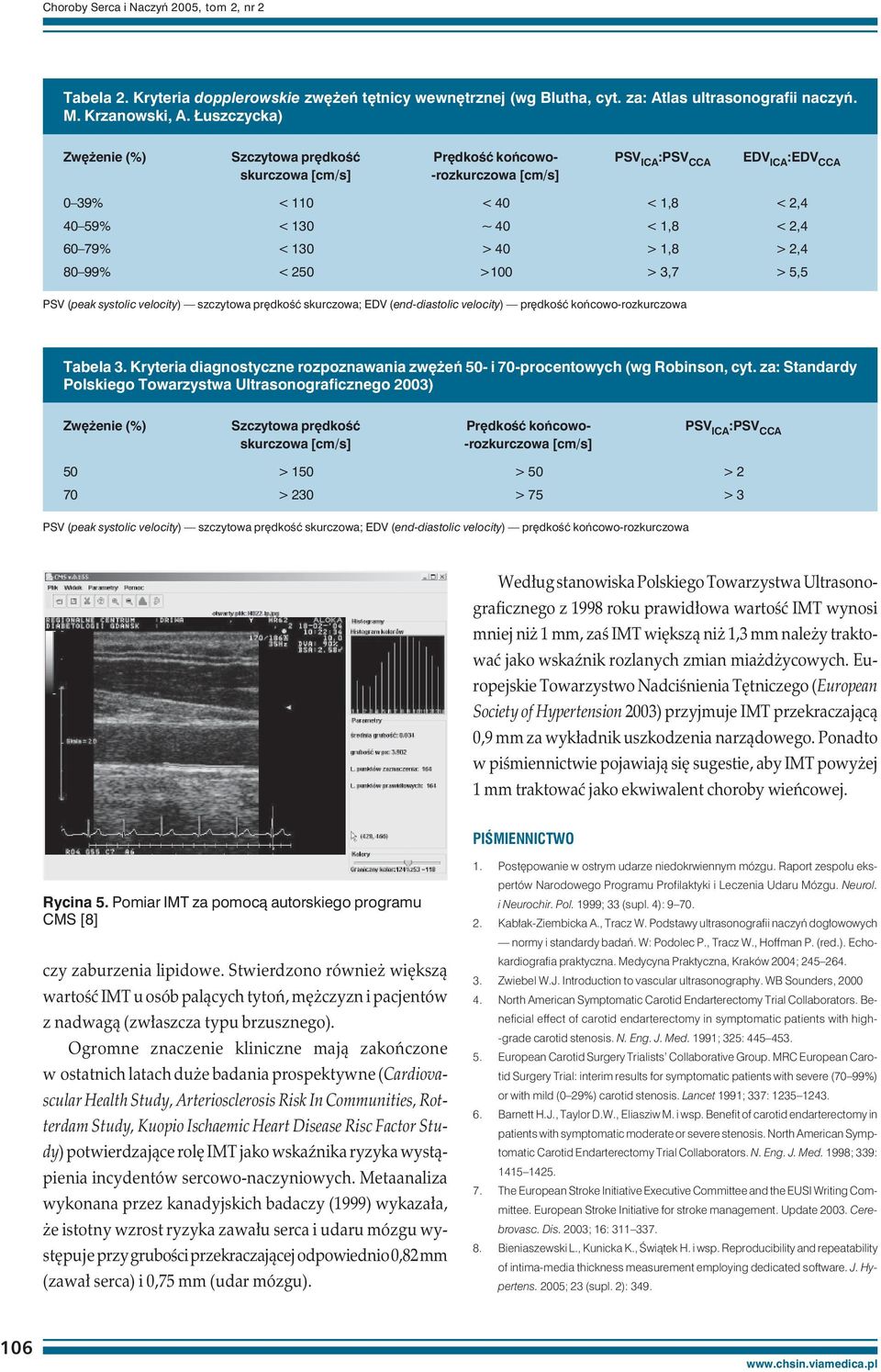 < 130 > 40 > 1,8 > 2,4 80 99% < 250 >100 > 3,7 > 5,5 PSV (peak systolic velocity) szczytowa prędkość skurczowa; EDV (end-diastolic velocity) prędkość końcowo-rozkurczowa Tabela 3.