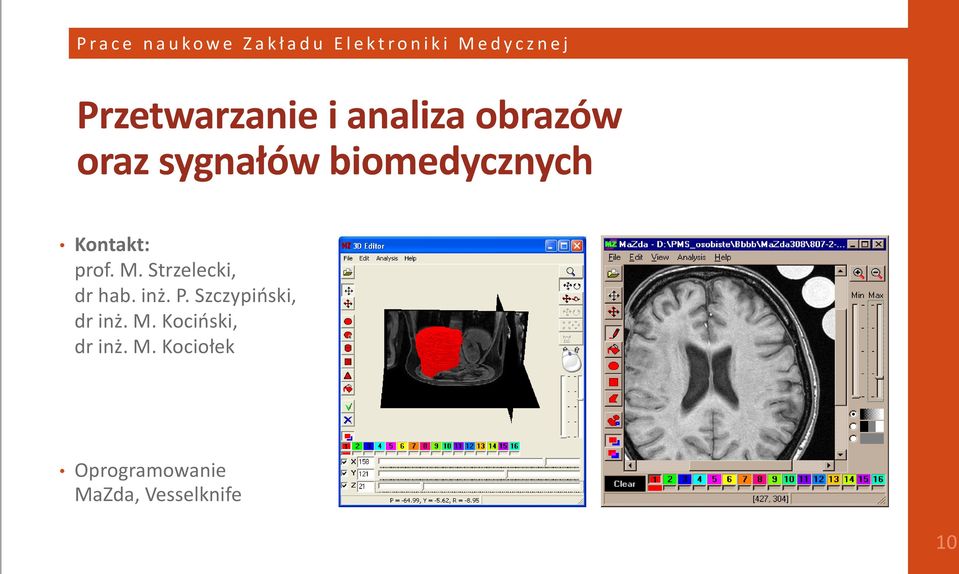 biomedycznych Kontakt: prof. M. Strzelecki, dr hab. inż. P.