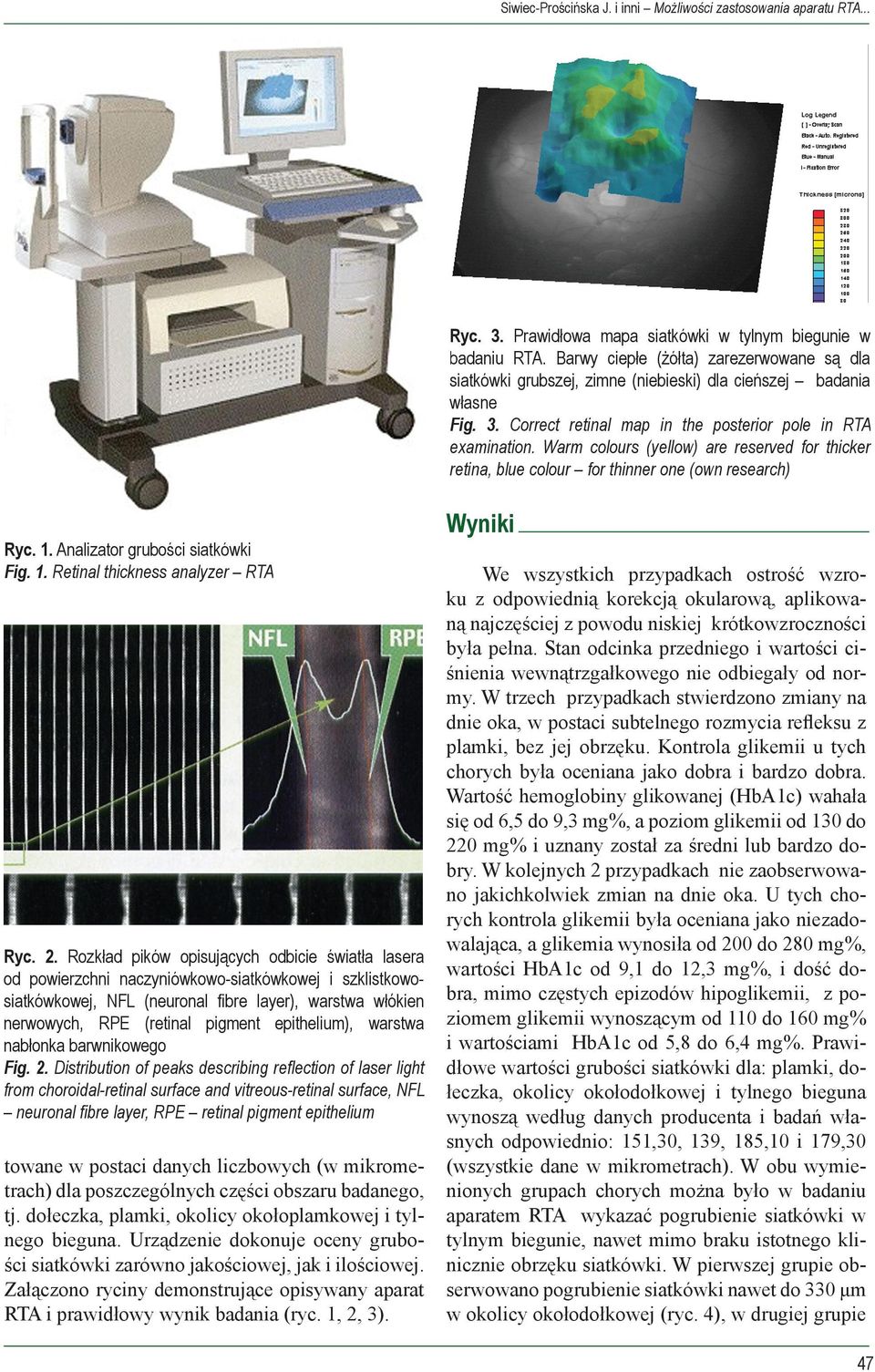 Warm colours (yellow) are reserved for thicker retina, blue colour for thinner one (own research) Ryc. 1. Analizator grubości siatkówki Fig. 1. Retinal thickness analyzer RTA Ryc. 2.