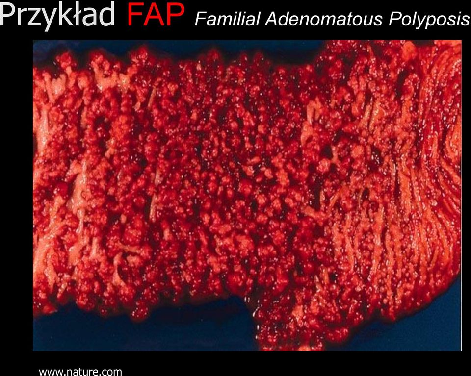 Adenomatous