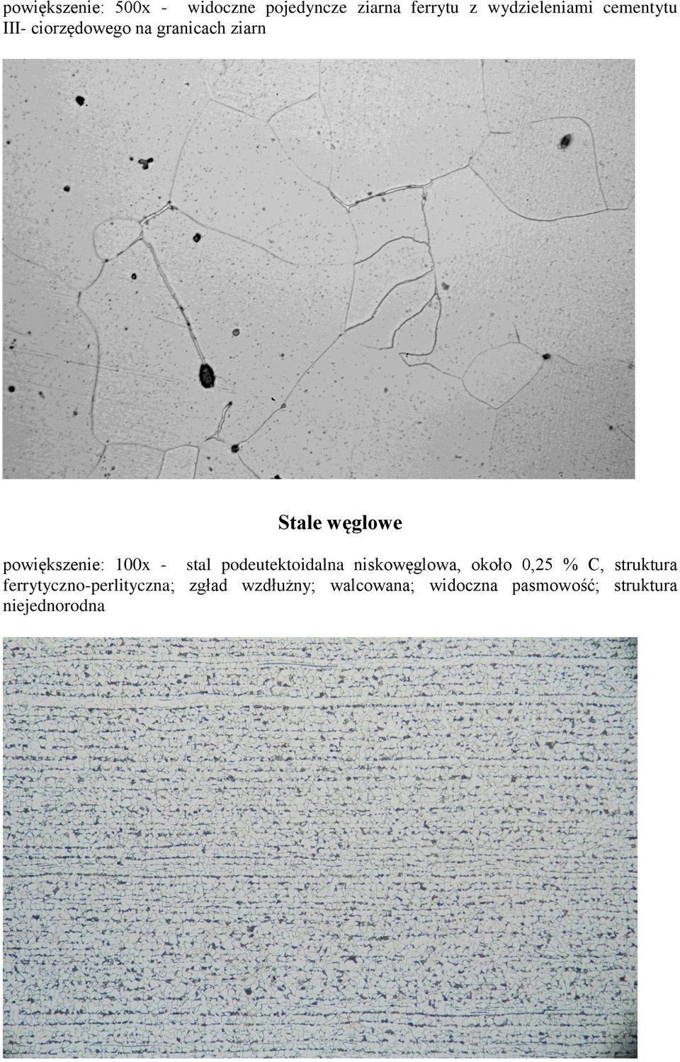 100x - stal podeutektoidalna niskowęglowa, około 0,25 % C, struktura