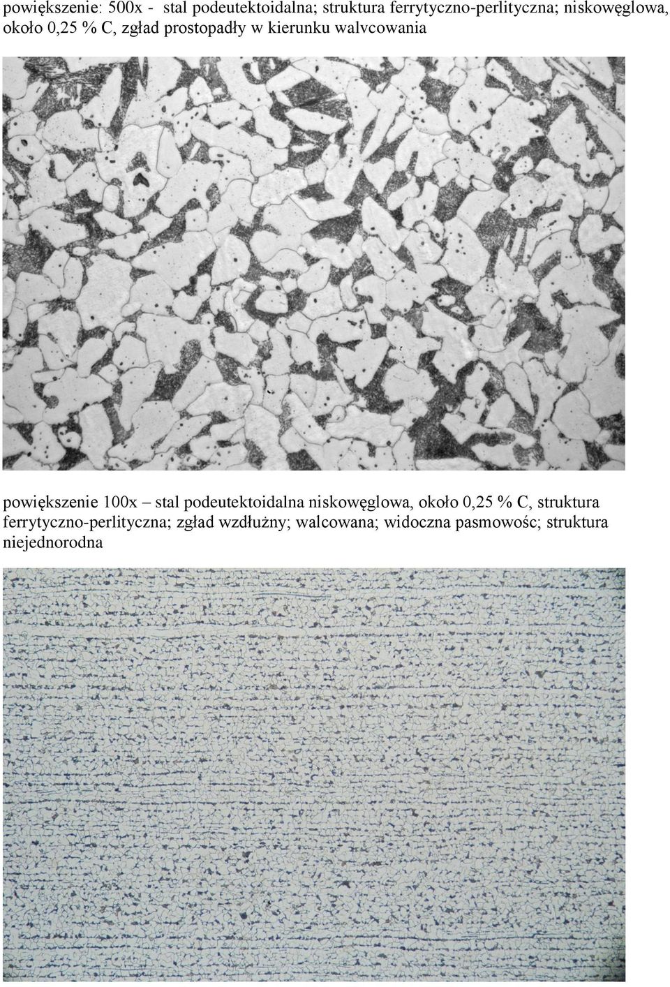 powiększenie 100x stal podeutektoidalna niskowęglowa, około 0,25 % C, struktura