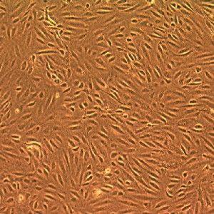 MODEL IN VITRO Human Microvascular Endothelial Cells (HMEC-1) ważna funkcja w procesie angiogenezy unieśmiertelniona