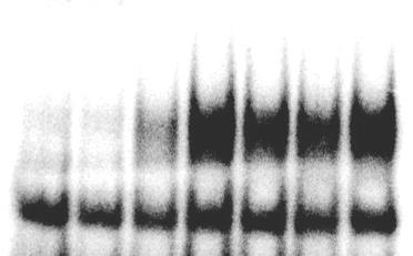 luciferase activity HIF1α activity [% of control] AKTYWACJA HIFs W HMEC-1 Badanie aktywności genu reporterowego HRE luciferaza EMSA 0 30 1h 3h 6h 12h 24h HIF-1 HRE hypoxia response element element