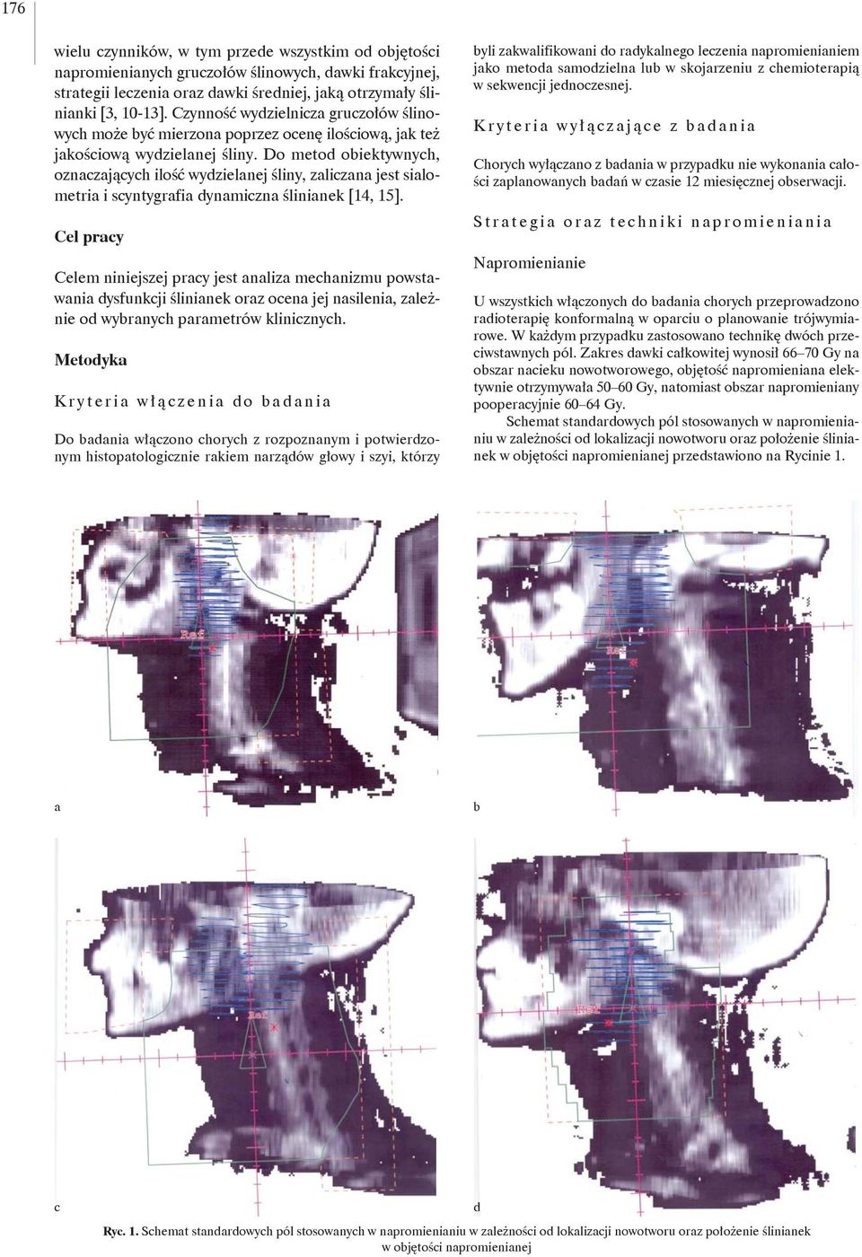 Do metod obiektywnych, oznaczających ilość wydzielanej śliny, zaliczana jest sialometria i scyntygrafia dynamiczna ślinianek [4, 5].