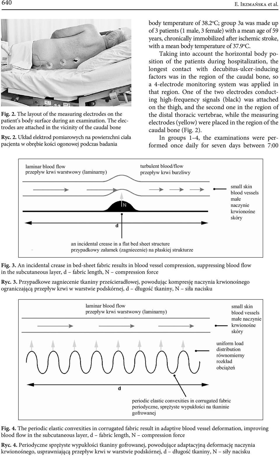 Taking into account the horizontal body position of the patients during hospitalization, the longest contact with decubitus-ulcer-inducing factors was in the region of the caudal bone, so a