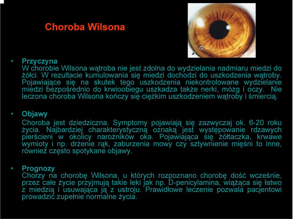 Nie leczona choroba Wilsona kończy się ciężkim uszkodzeniem wątroby i śmiercią. Objawy Choroba jest dziedziczna. Symptomy pojawiają się zazwyczaj ok. 6-20 roku życia.