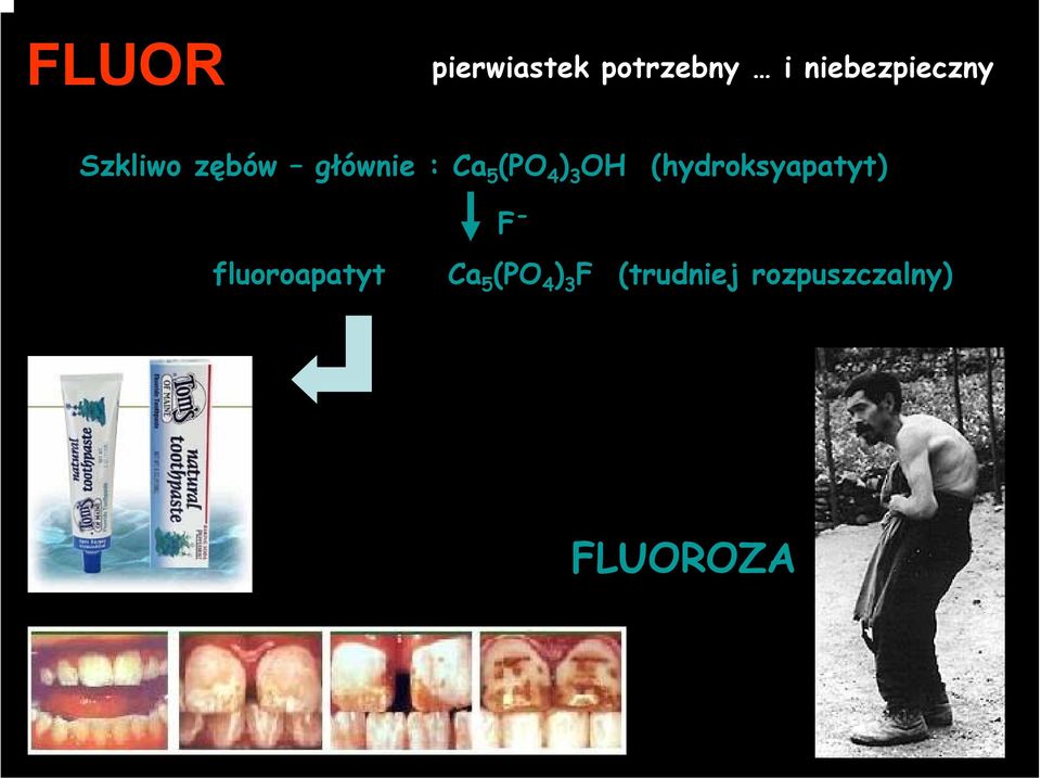 (PO 4 ) 3 OH (hydroksyapatyt) F -