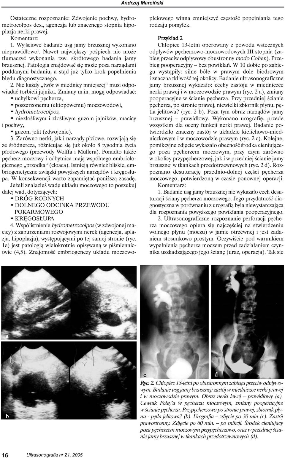 Patologia znajdowaç si mo e poza narzàdami poddanymi badaniu, a stàd ju tylko krok pope nienia b du diagnostycznego. 2. Nie ka dy twór w miednicy mniejszej musi odpowiadaç torbieli jajnika. Zmiany m.