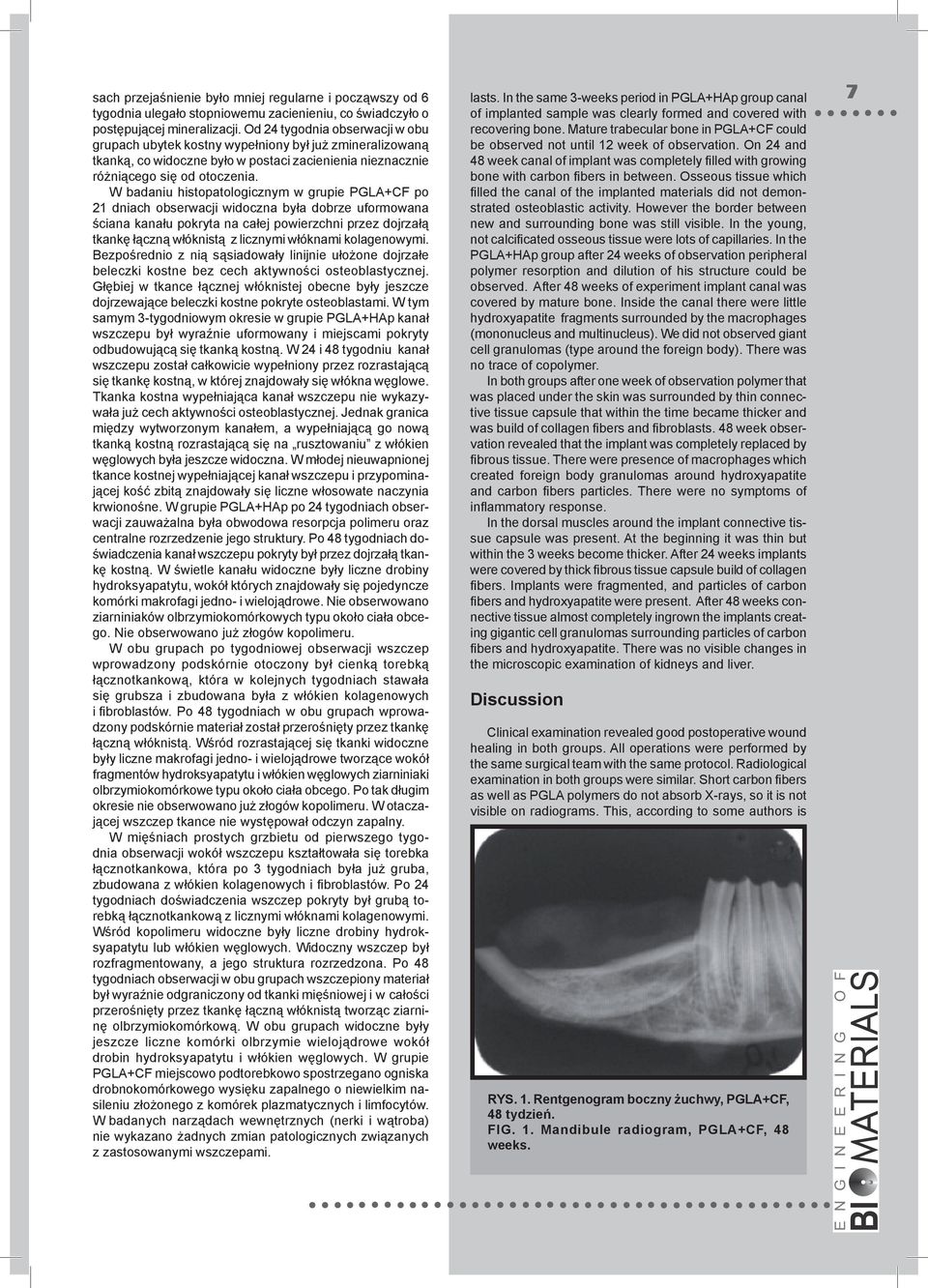 W badaniu histopatologicznym w grupie PGLA+CF po 21 dniach obserwacji widoczna była dobrze uformowana ściana kanału pokryta na całej powierzchni przez dojrzałą tkankę łączną włóknistą z licznymi