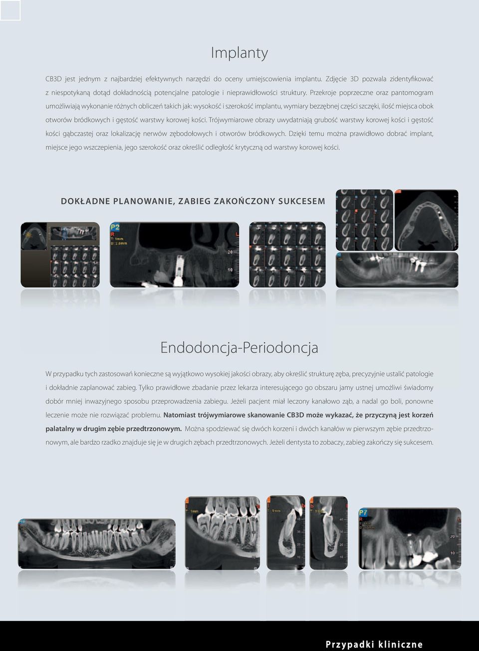 Przekroje poprzeczne oraz pantomogram umożliwiają wykonanie różnych obliczeń takich jak: wysokość i szerokość implantu, wymiary bezzębnej części szczęki, ilość miejsca obok otworów bródkowych i