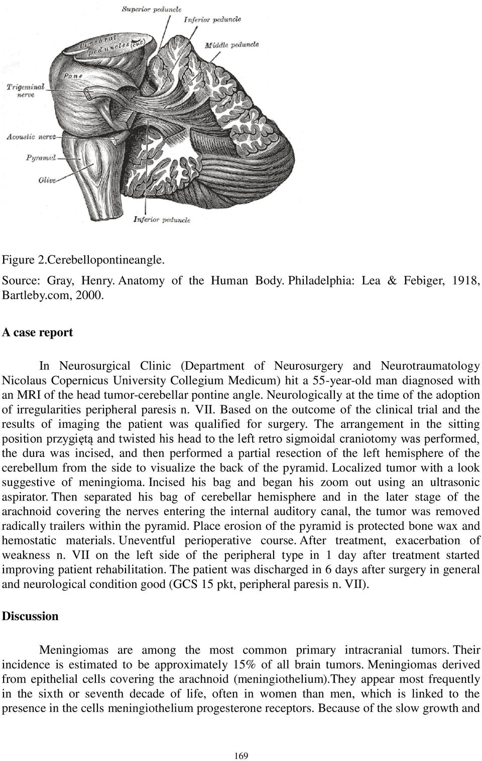 tumor-cerebellar pontine angle. Neurologically at the time of the adoption of irregularities peripheral paresis n. VII.