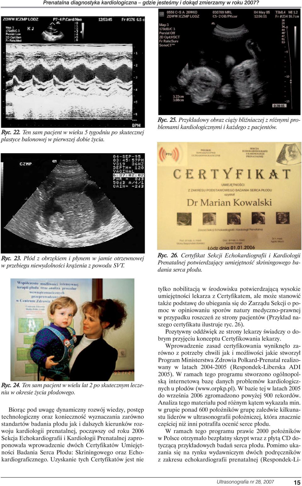 Ryc. 26. Certyfikat Sekcji Echokardiografii i Kardiologii Prenatalnej potwierdzajàcy umiej tnoêç skriningowego badania serca p odu. Ryc. 24.