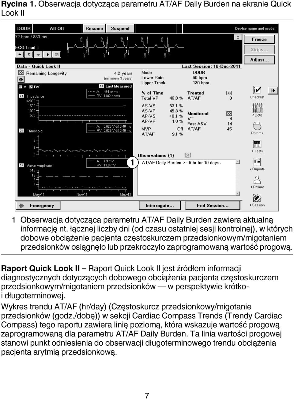 progową.