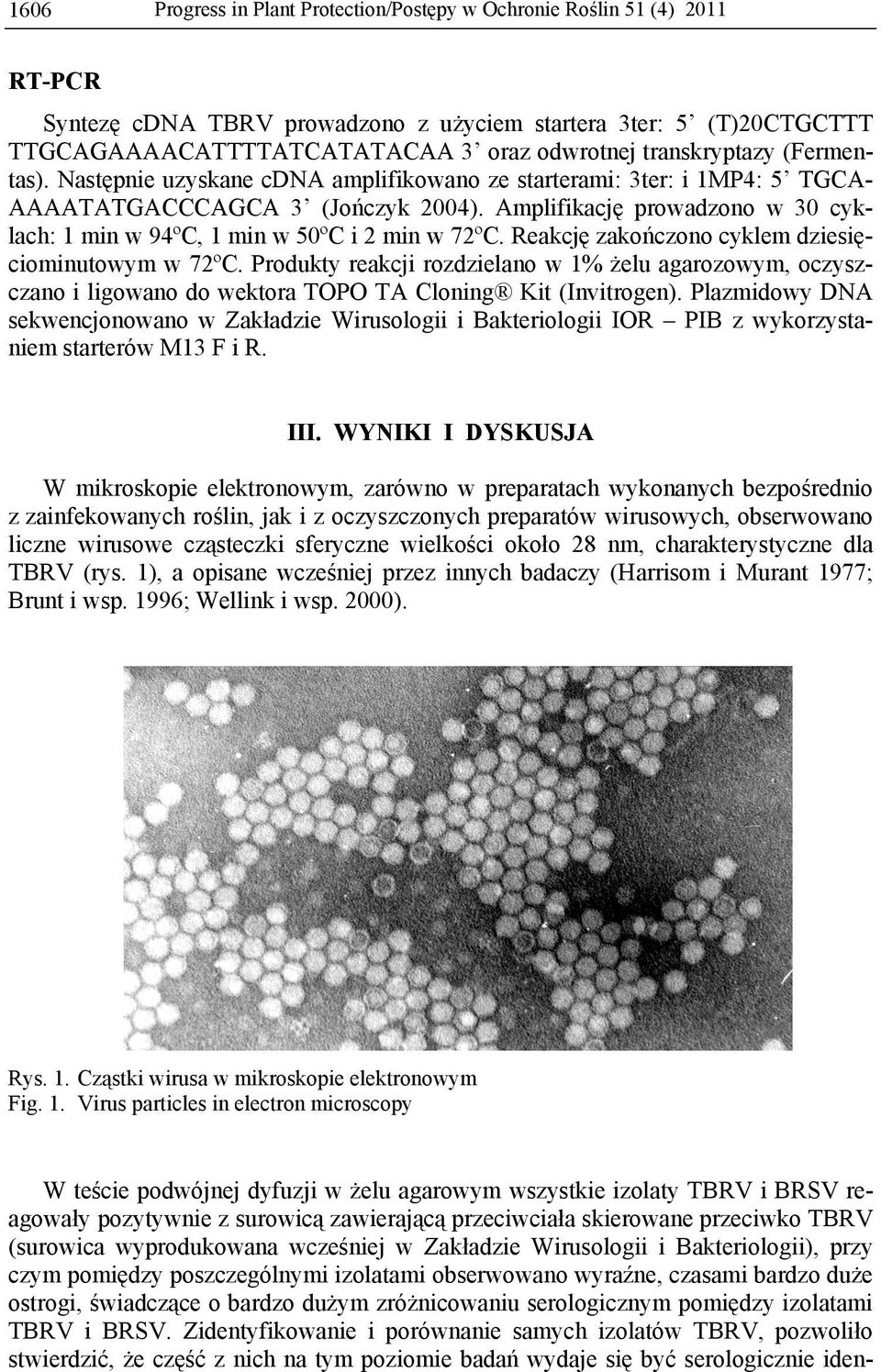 Amplifikację prowadzono w 30 cyklach: 1 min w 94ºC, 1 min w 50ºC i 2 min w 72ºC. Reakcję zakończono cyklem dziesięciominutowym w 72ºC.