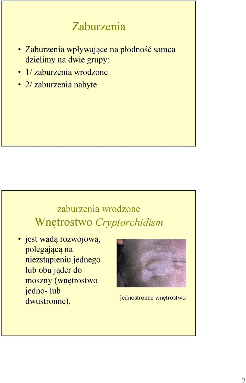 Cryptorchidism jest wadą rozwojową, polegającą na niezstąpieniu jednego lub